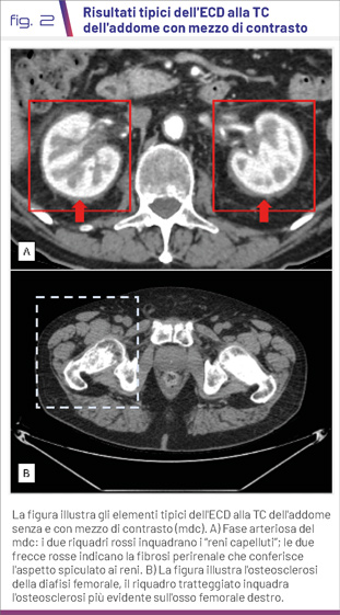 fig2